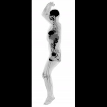 Новая веха в медицине: Создан первый в мире сканер для всего тела